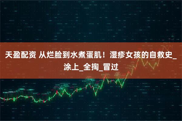 天盈配资 从烂脸到水煮蛋肌！湿疹女孩的自救史_涂上_全掏_冒过